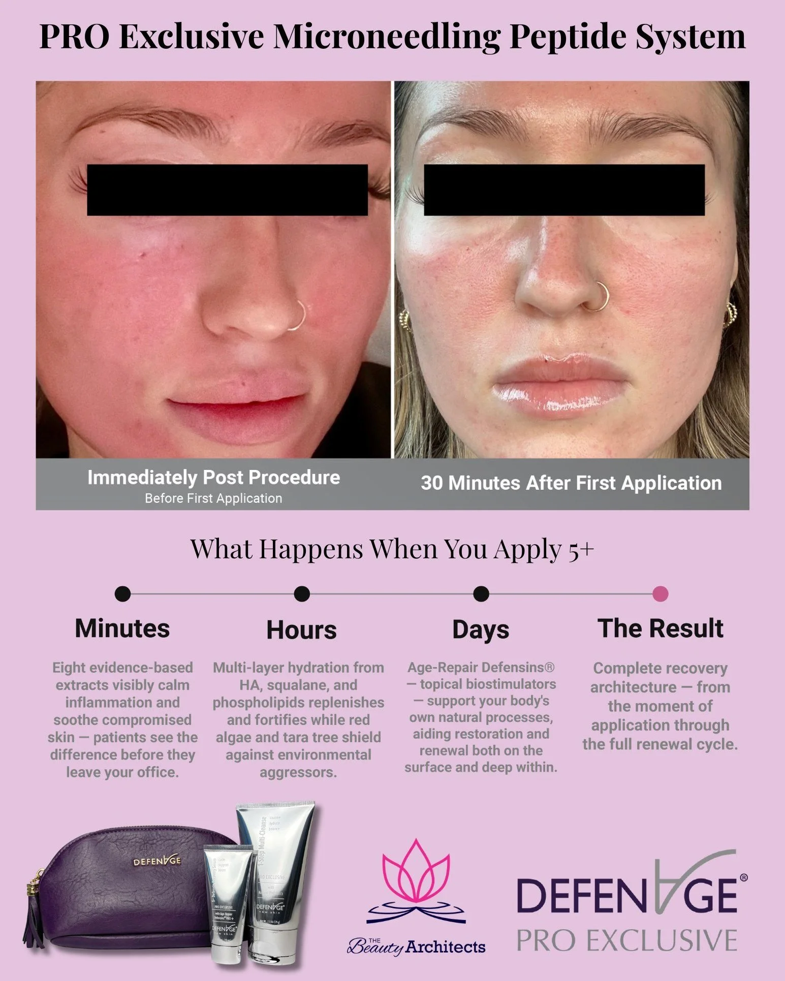 Introducing the PRO Exclusive - Microneedling Peptide System ✨

➡️ DM us to claim yours and experience the glow for yourself!