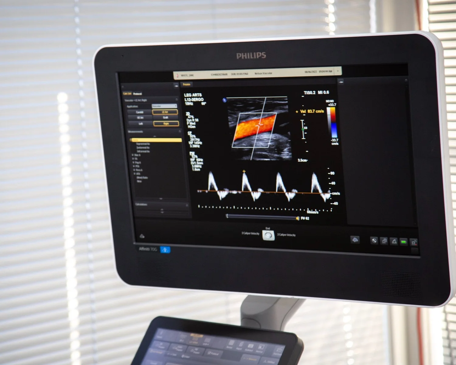 Our Services — Avanti Ultrasound Hamilton