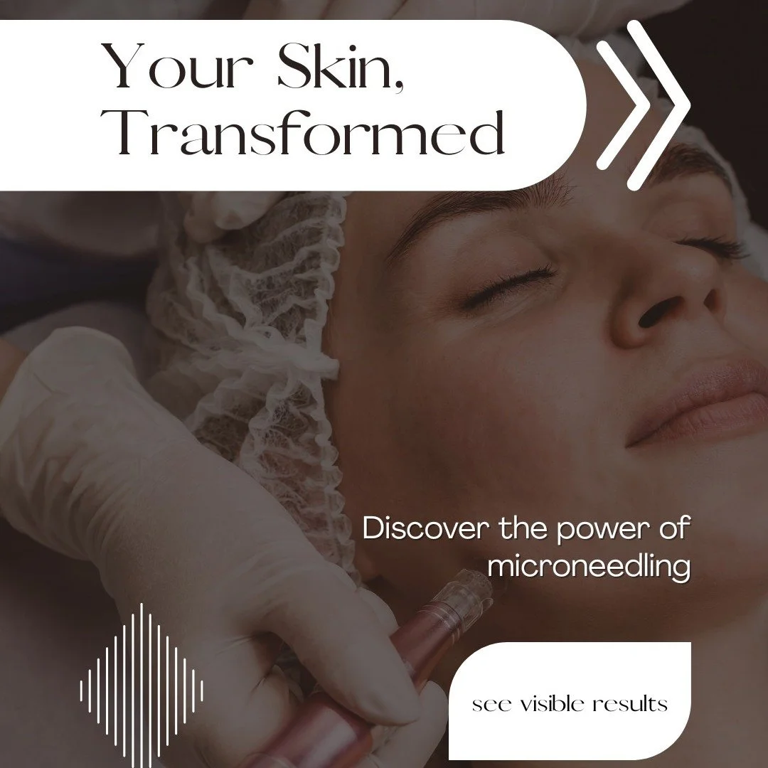 🍂✨ Fall + Winter are the perfect seasons for Microneedling! ✨🍂

Microneedling is one of the most effective ways to naturally stimulate collagen + elastin production, helping your skin look smoother, firmer, and more radiant. During the cooler month