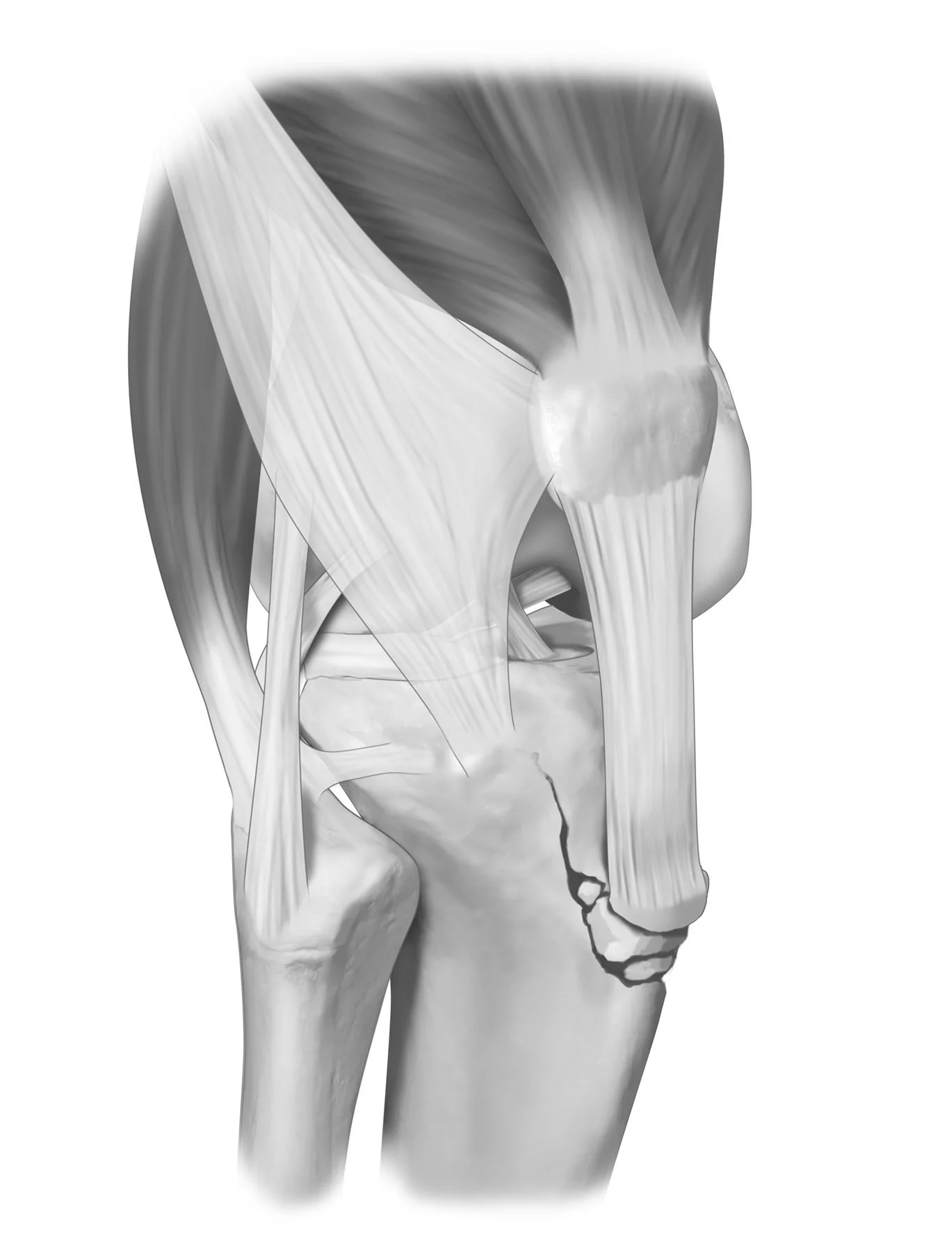 Osgood Schlatter — Nick The Knee MD