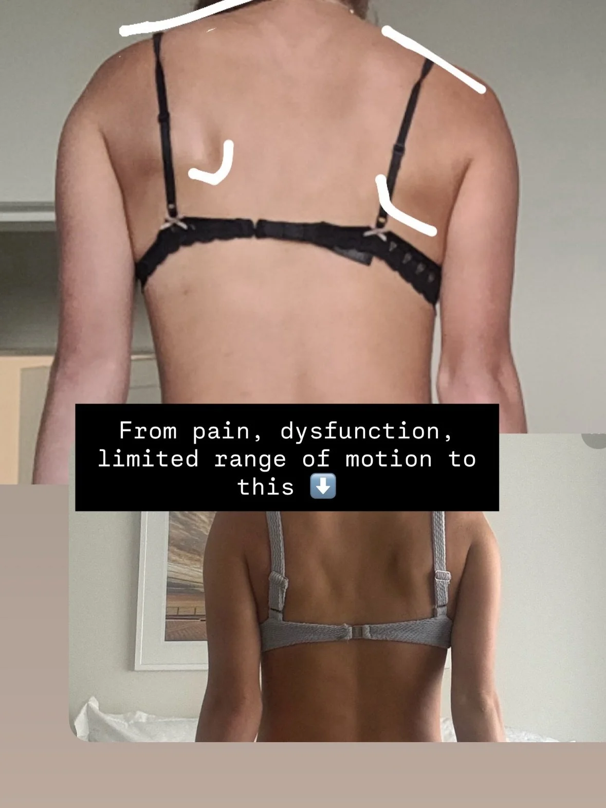 What happens when you commit for the long run. 
Not just how your body looks&mdash;but how it moves, feels, and performs. 💪

No chasing the &ldquo;fix for scoliosis&rdquo; or a &ldquo;winging scapula.&rdquo; Instead the focus was function, strength,