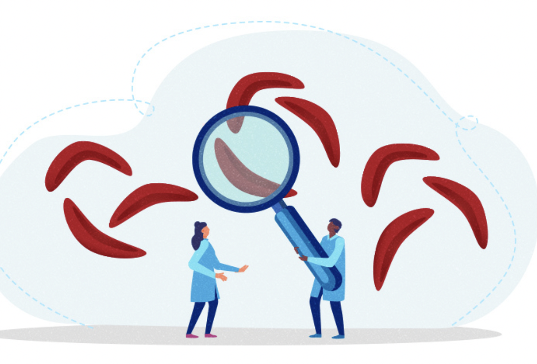 Sickle Cell Disease: What is it?