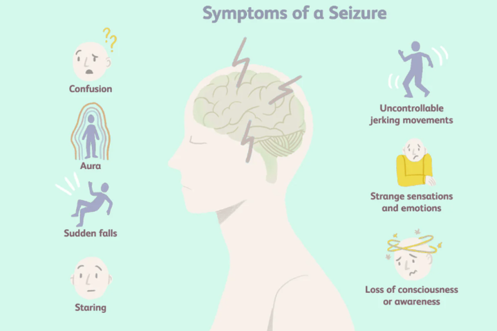 Seizures: Inside the Mind