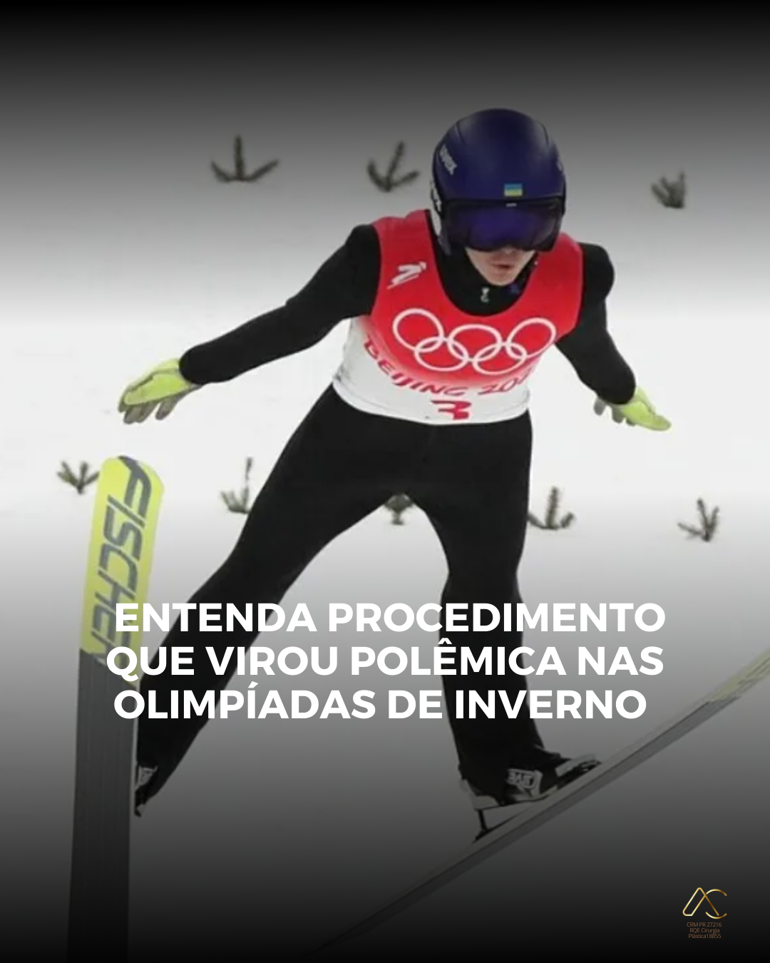 Aumento Peniano com Ácido Hialurônico: A Polêmica nas Olimpíadas, o Que é Verdade e o Que Pacientes Precisam Saber