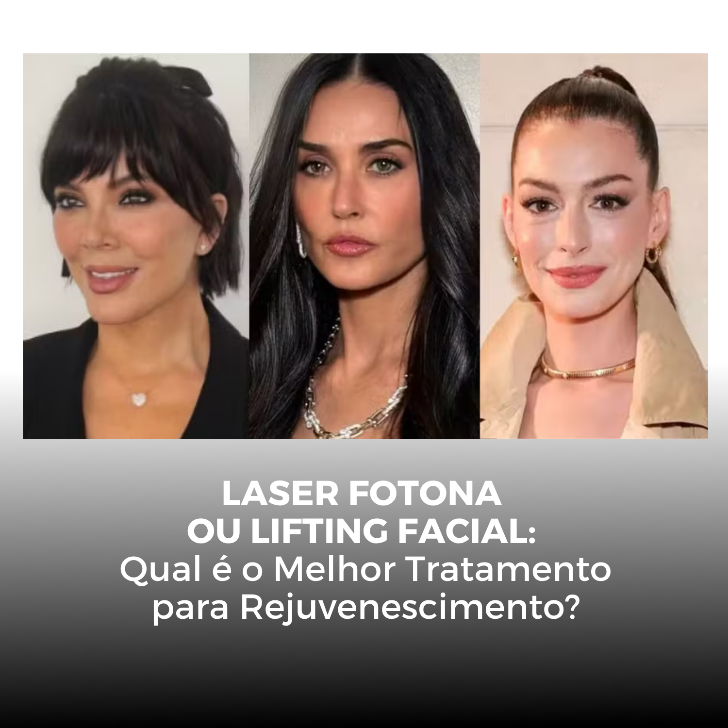 Laser Fotona ou Lifting Facial: Qual é o Melhor Tratamento para Rejuvenescimento?