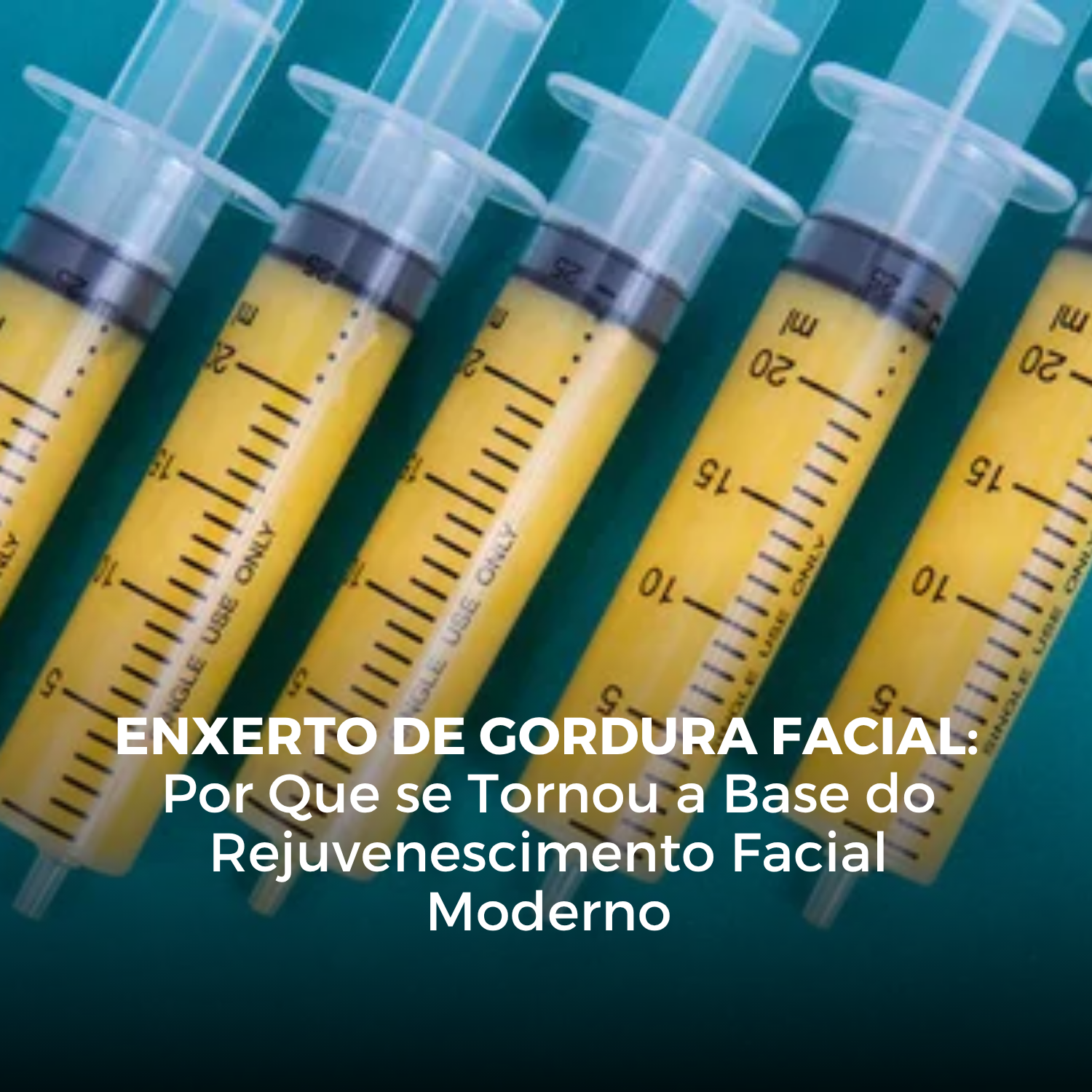 Enxerto de Gordura Facial: Por Que se Tornou a Base do Rejuvenescimento Facial Moderno
