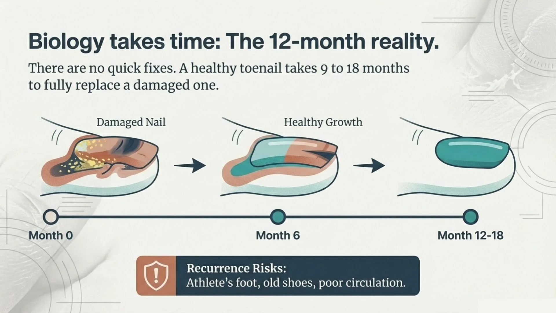 Timeline showing nail healing process from damaged nail at month 0, healthy growth at month 6, to fully grown nail at months 12 to 18, with a note on recurrence risks like athlete's foot, old shoes, and poor circulation.