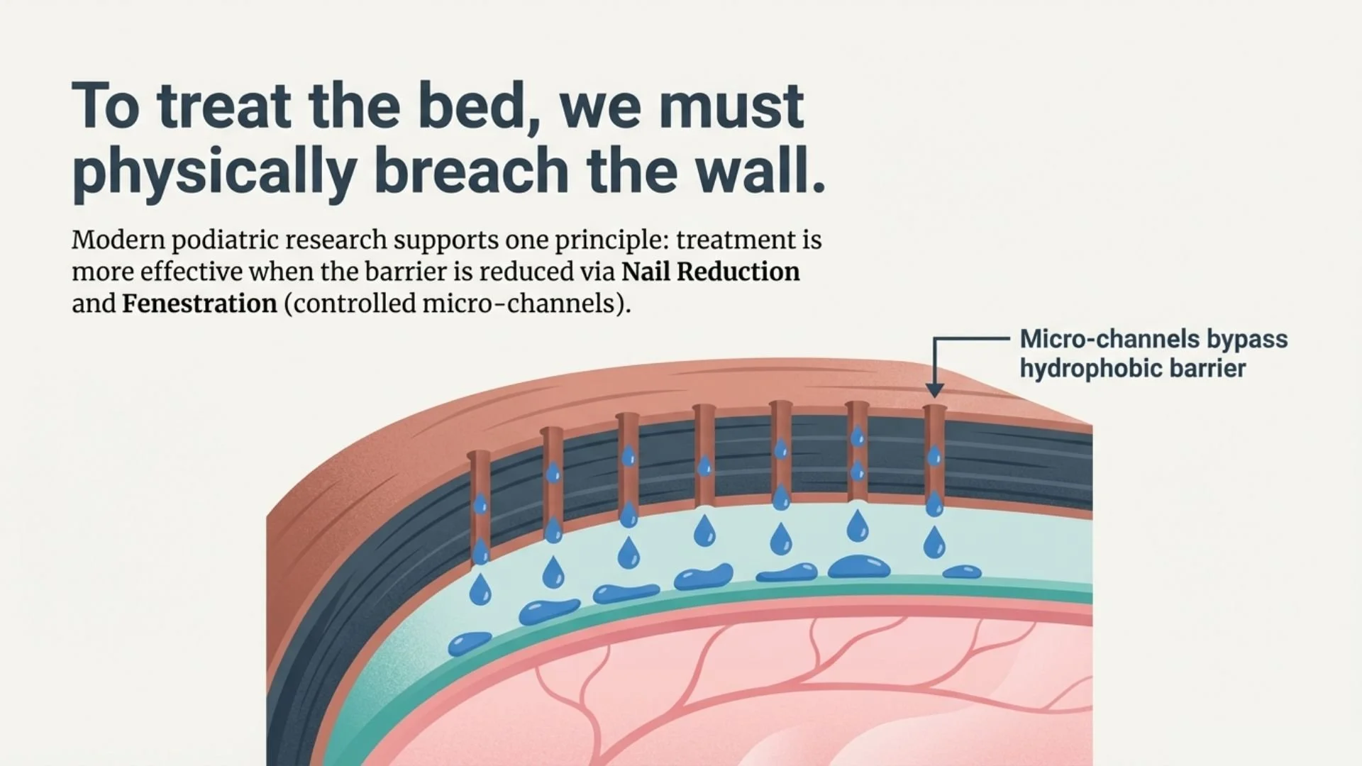Illustration of a micro-channel bypass hydrophobic barrier in a medical diagram, showing water droplets passing through controlled micro-channels to breach the wall for treatment.