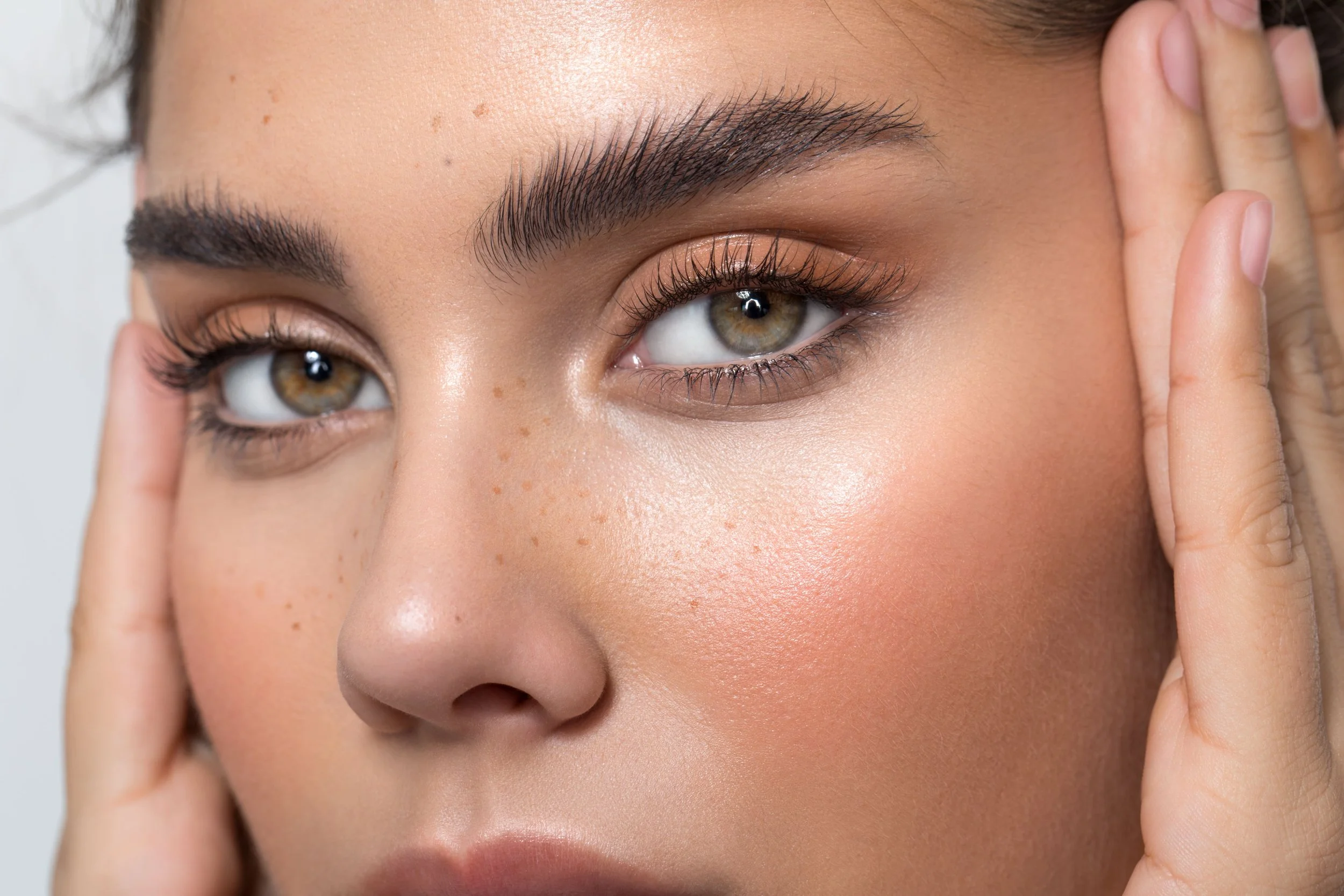 melasma treatment palm beach gardens
