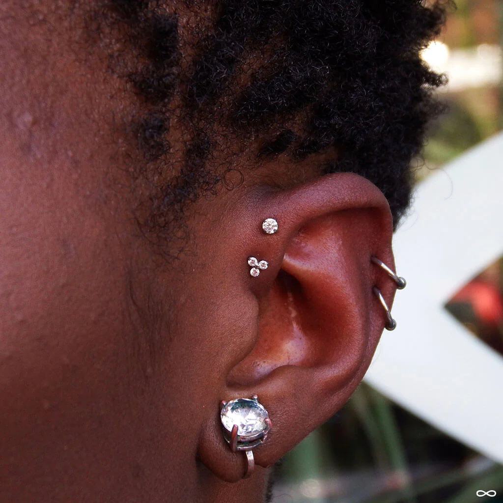 Forward Helix
