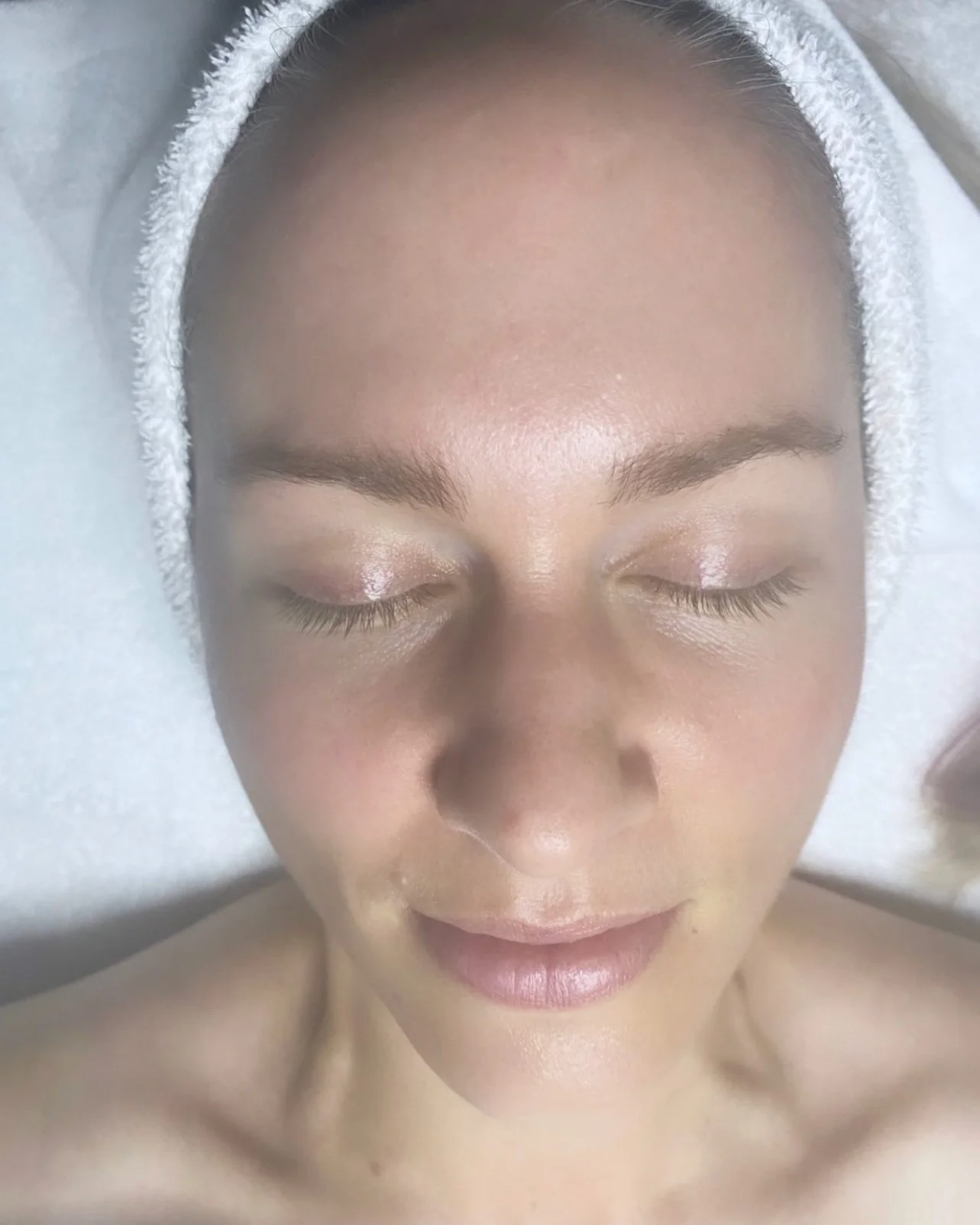 A woman receiving a facial treatment, lying down with eyes closed, wrapped in a towel with her head resting on a pillow.