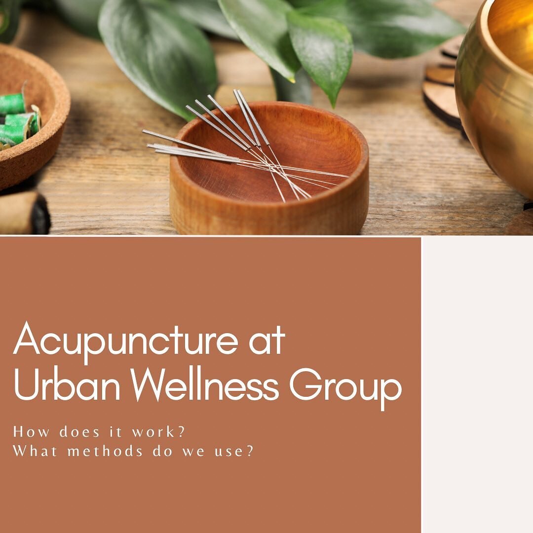 ACUPUNCTURE AT URBAN WELLNESS GROUP ___________________________

There are numerous theories about how acupuncture works. Some of them are:
acupuncture stimulates the release of pain-relieving endorphins
acupuncture influences the release of neurotra