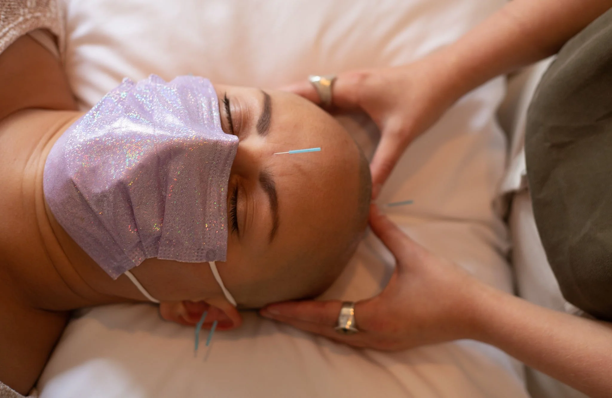 Person wearing mask receives acupuncture on scalp and face