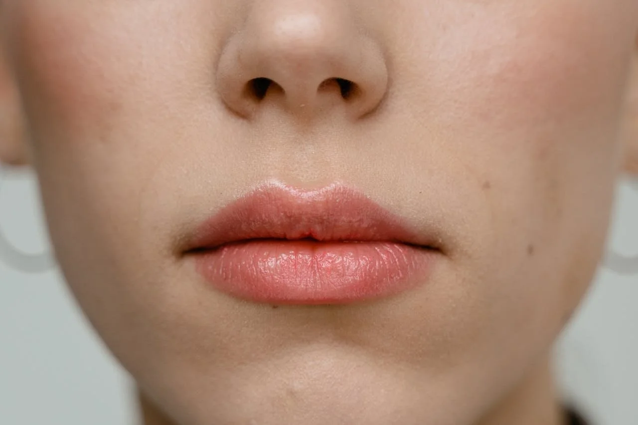 What to Expect After Lip Fillers in the First Week