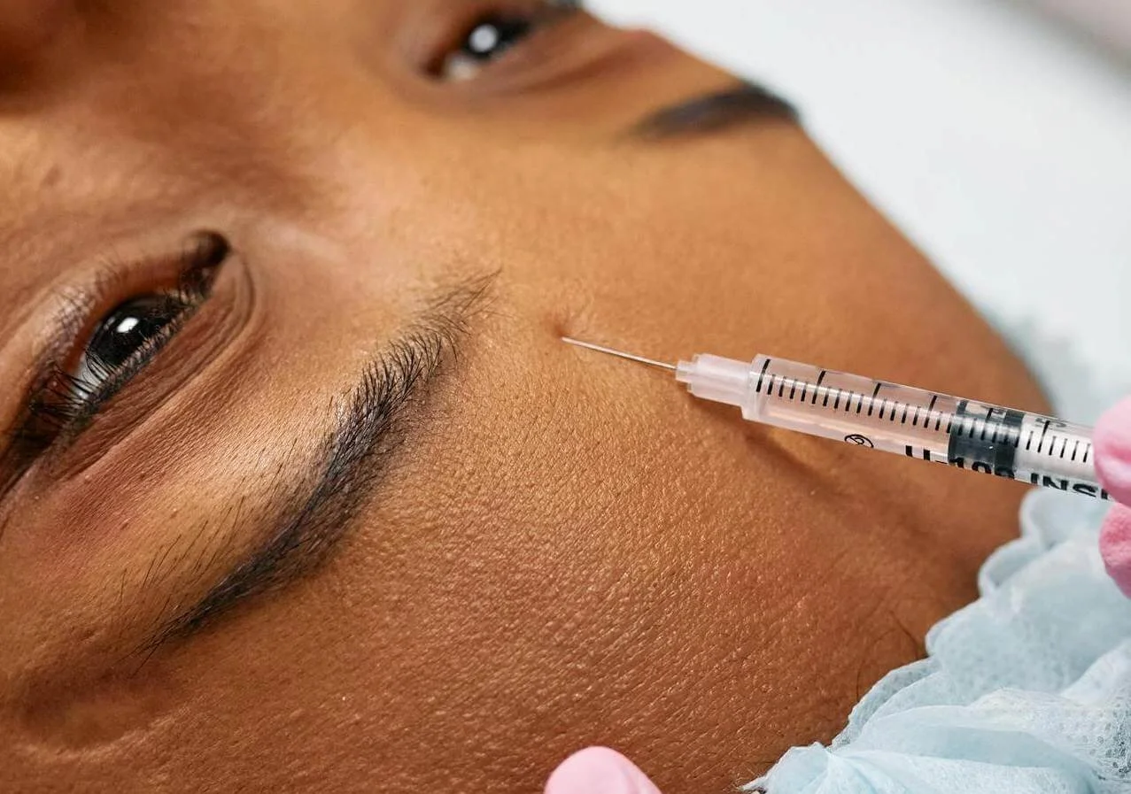 How Long Does Botox Last? Timeline &amp; What Affects It