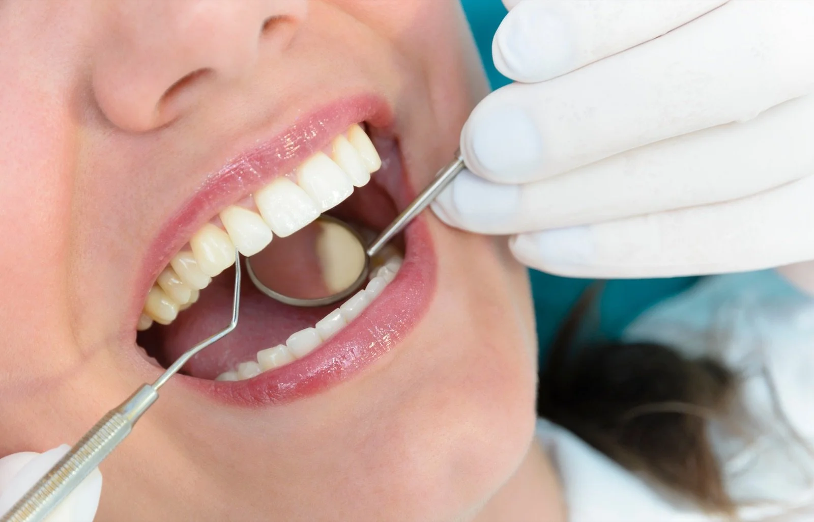 Does getting a cavity filled hurt?