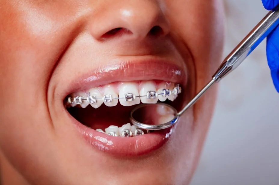 How Often Should I See My Dentist?