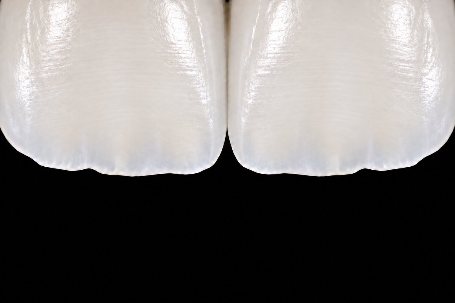 Illustration: close-up of two ceramic veneers showing a polished surface and translucent edges