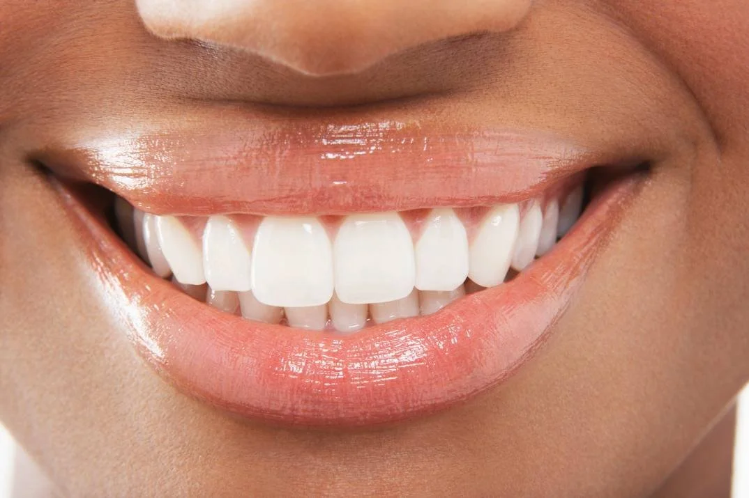 Close-up of a smiling mouth with straight white teeth and glossy lips