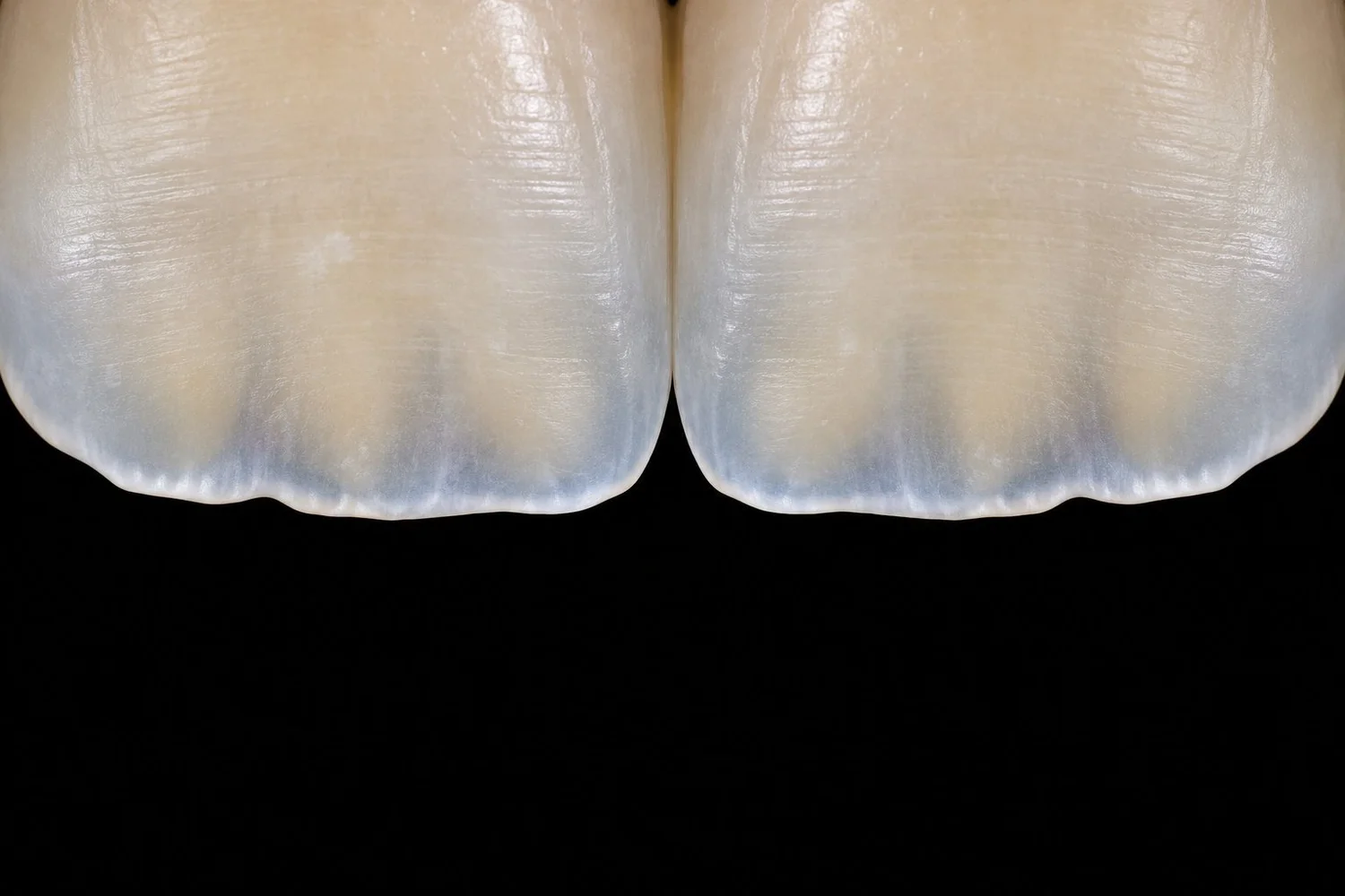 Illustration: close-up of front teeth showing translucent edges and the subtle lobes of dentine within them