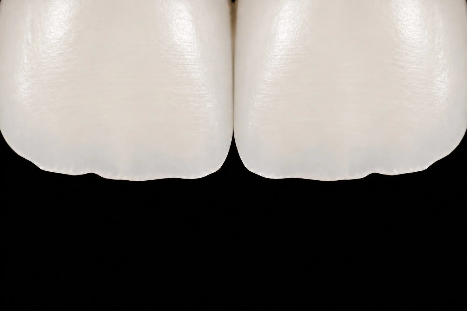 Illustration: close-up of two composite veneers showing a more uniform colour and softer surface sheen