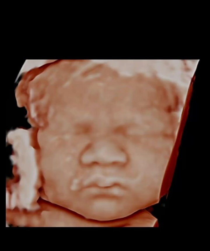 We&rsquo;ve been absolutely loving the 8K images lately! Isn&rsquo;t it amazing how your 3D ultrasound can be brought to life? It still blows us away every single time!

#ultrasound #3dultrasound #babygirl #montgomery #alabama #3d4dultrasound #4dultr