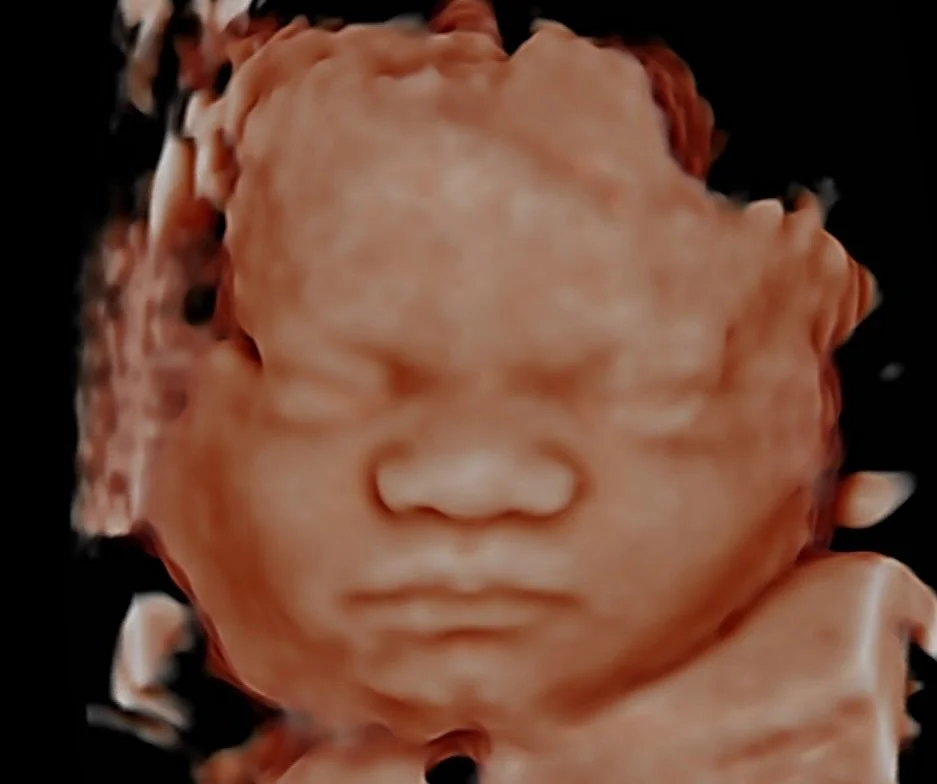 Sweet baby boy did amazing! 🩵 

He was ready to show off his precious little face and gave us the sweetest poses. It&rsquo;s like he knew it was his moment to shine during his 3D ultrasound! ✨👶📸 

#3dultrasound #babyboy #ultrasound #montgomery #al