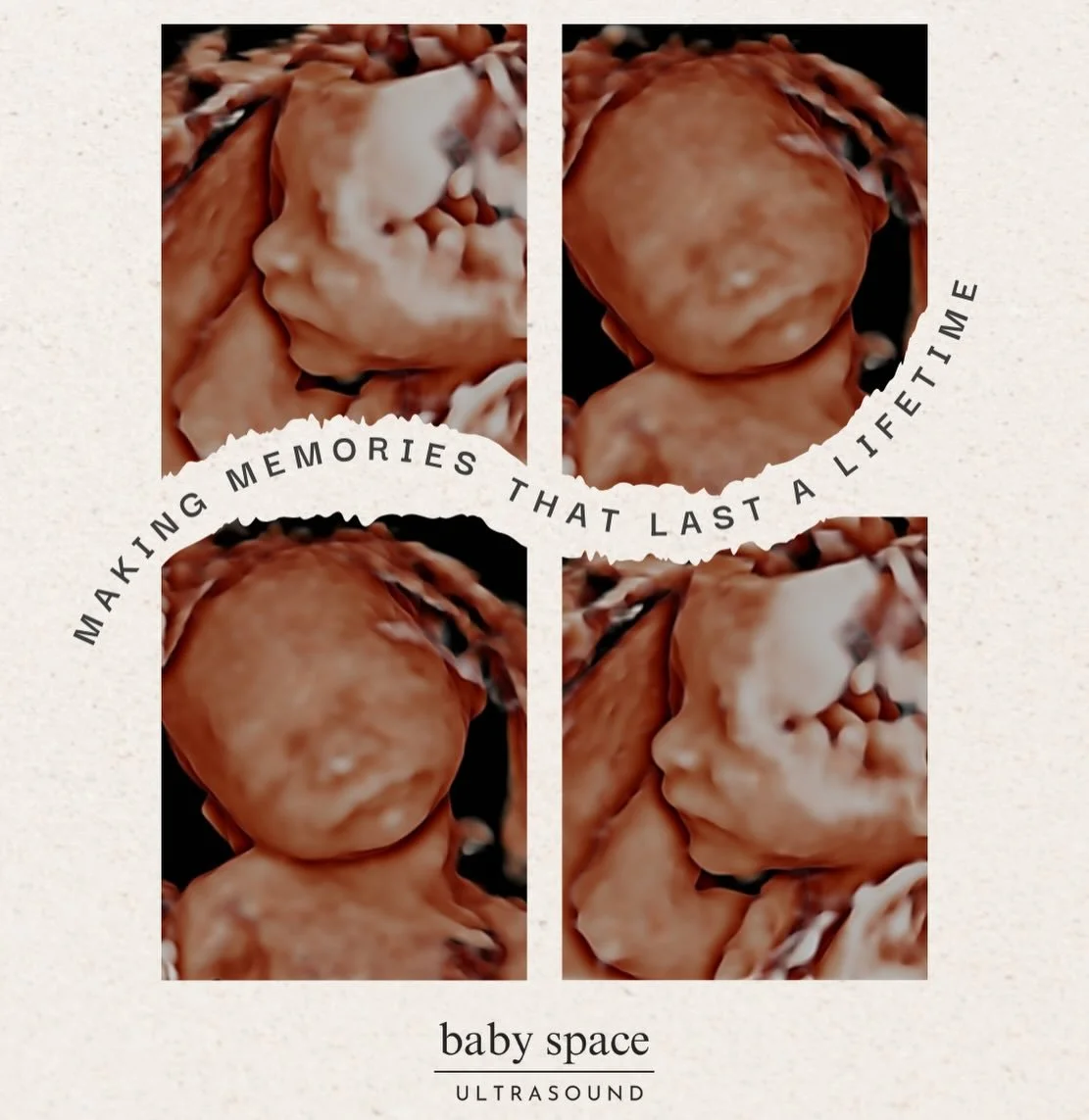 Making memories that last a lifetime. 🤍✨
Keep them forever in your heart.

From tiny kicks to sleepy yawns, we capture your baby&rsquo;s earliest moments with love, care, and intentions 
Sweet photos and videos you&rsquo;ll treasure for a lifetime! 