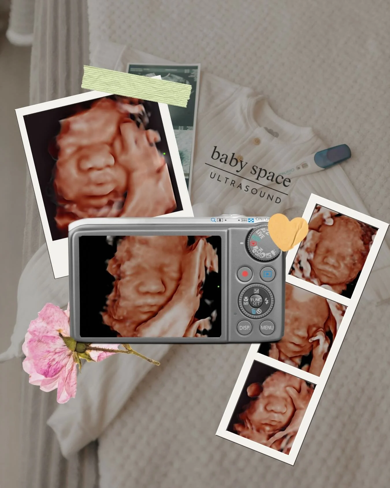 A little peek at some of the sweetest babies ever! We absolutely love when they show off during their ultrasound sessions 💕📸

#ultrasound #3d4dultrasound #babies #pregnancy