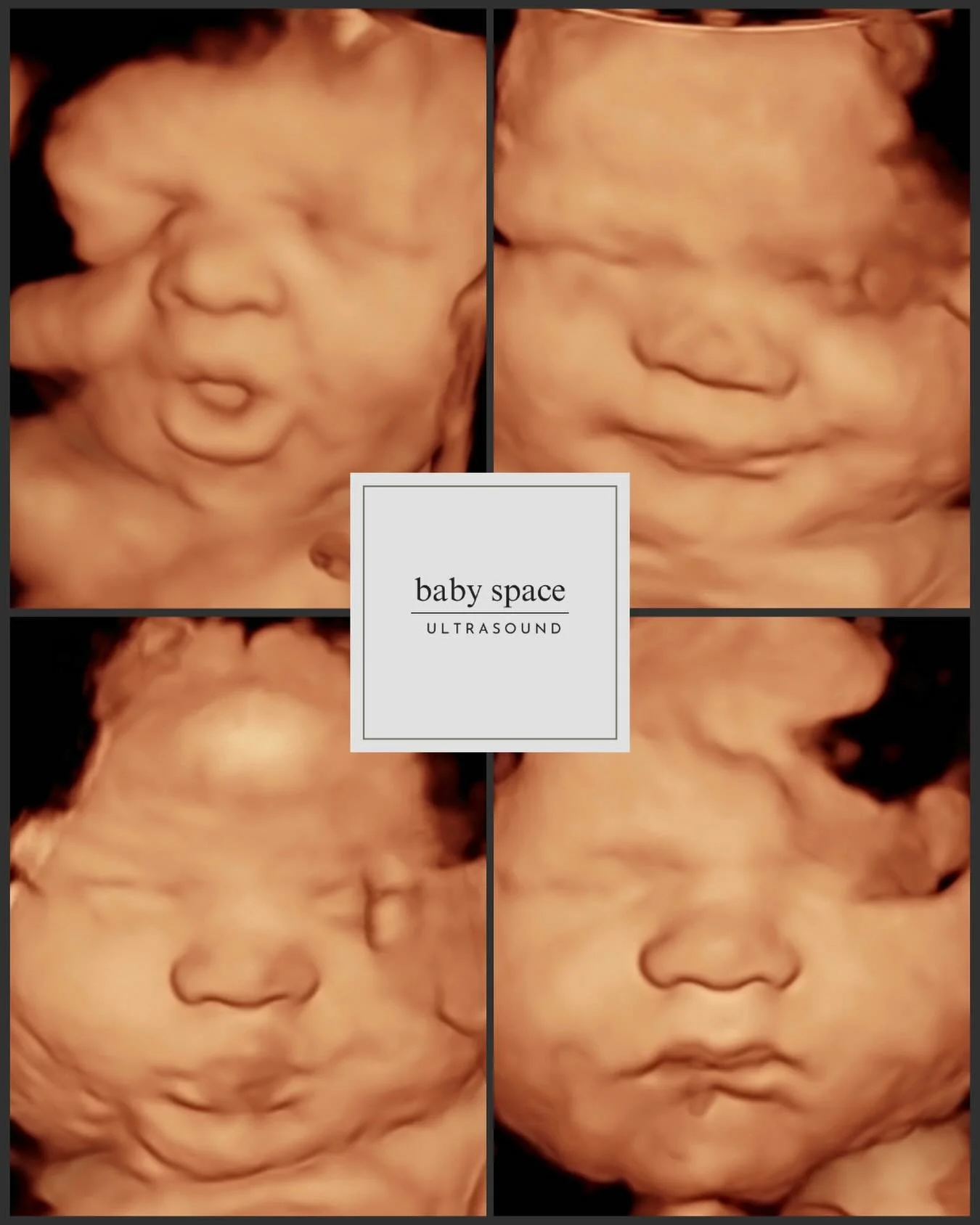 This sweet baby boy came to see us at 36 weeks and let me tell you, he understood the assignment.🥹
He gave mama the best views, like he already knows how loved he is.

It&rsquo;s so special getting to watch these last few weeks before they make thei