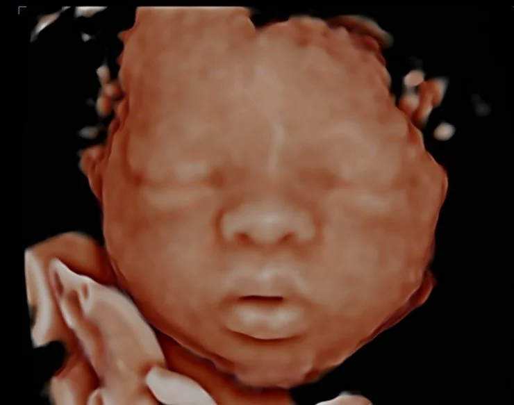 OH HELLO there!!! 😍

This sweet baby was definitely showing off for his session and we loved every second of it. Moments like these are exactly why we do what we do. There is nothing more special than watching families see their baby&rsquo;s face fo