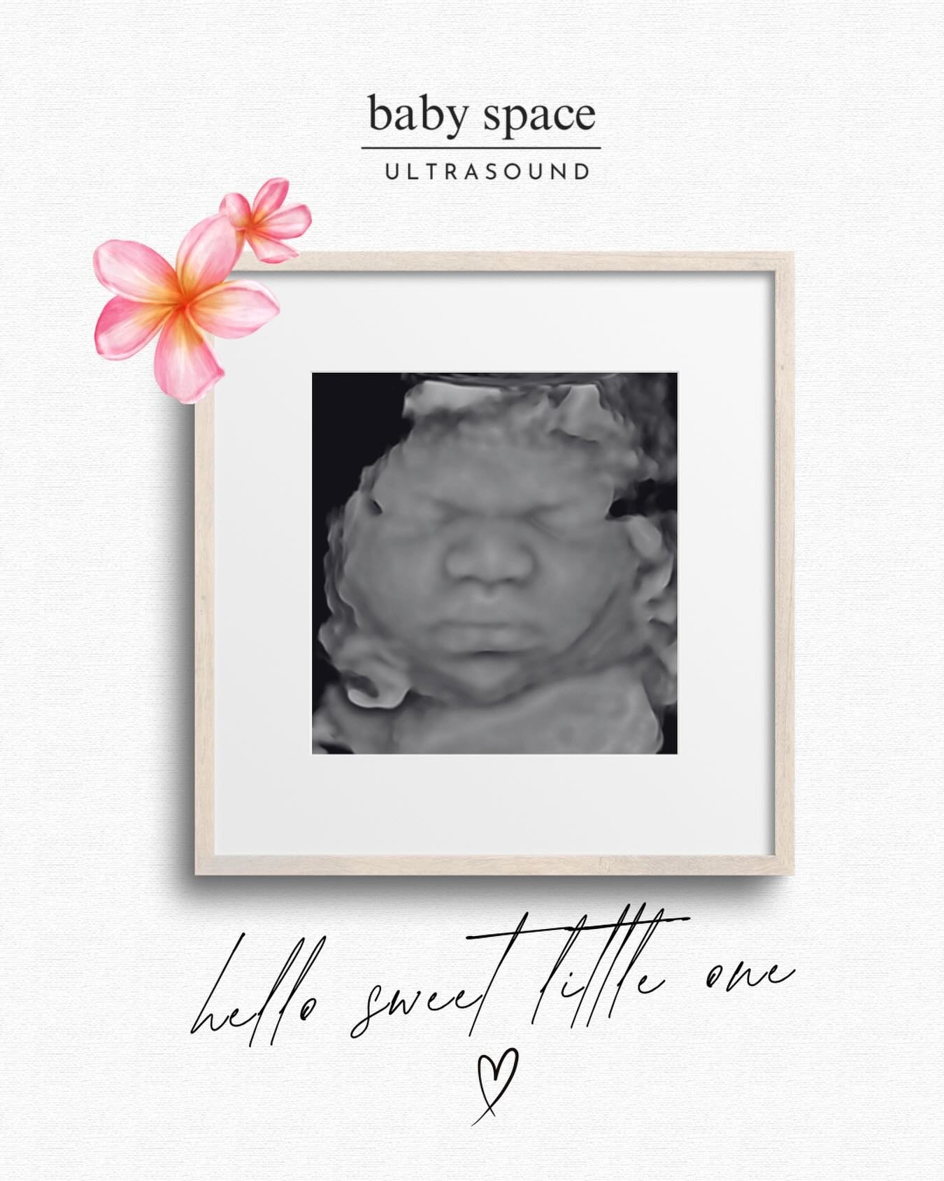 Mouth DROPPED when we saw these images! 🤩✨
Sweet baby girl is an absolute superstar already, just WOW, WOW, WOW! 💕

Mama is 37 weeks and doing amazing! Her fluid look beautiful 👏🏼✨ You can definitely tell she&rsquo;s been staying hydrated! 

This