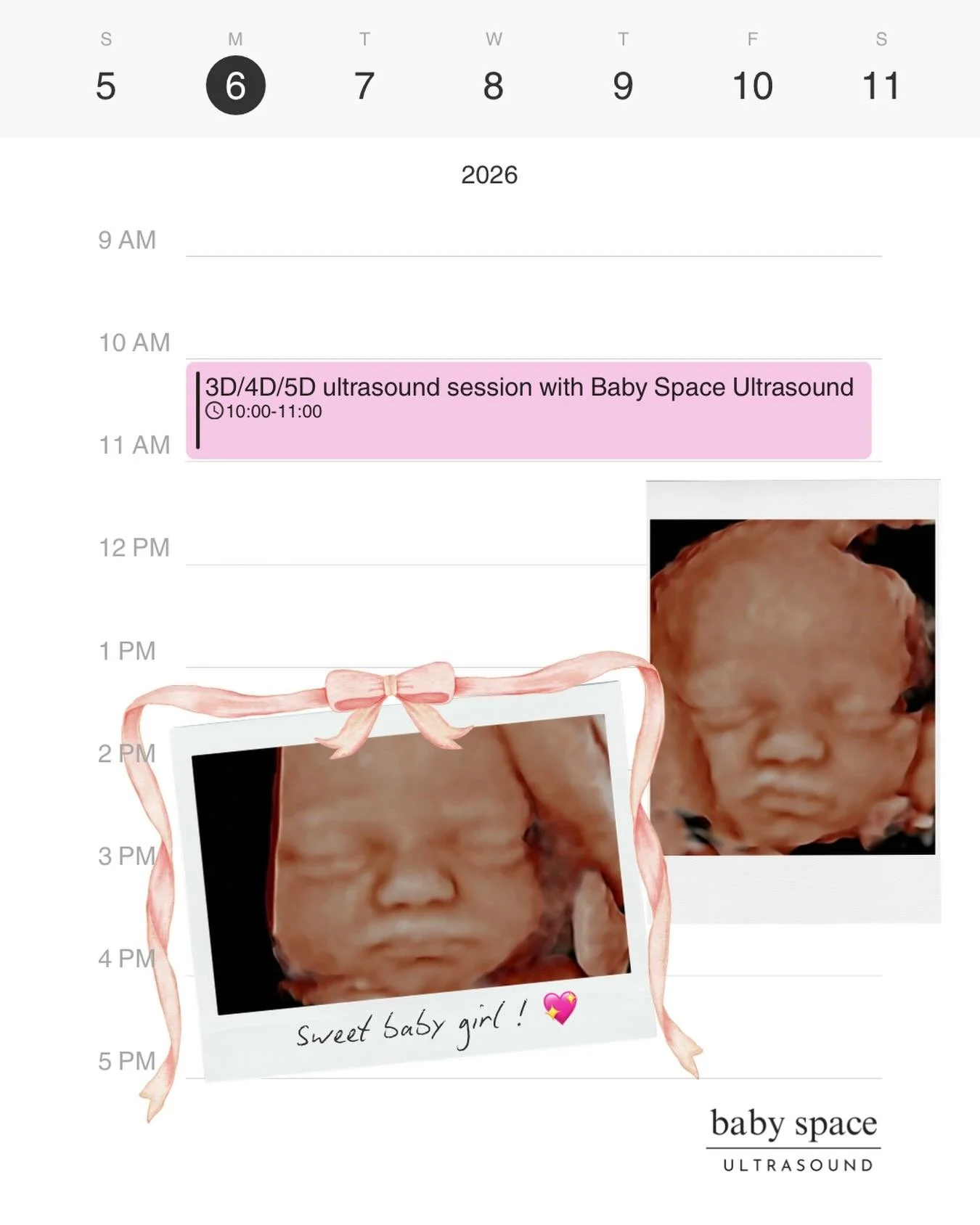 Ohhh look at this sweet girl! 💕

The best time to come in is 30&ndash;33 weeks, when baby is filling out and those features really come to life! 🥹
Think: chubby cheeks, tiny lips, little nose, and even hair sometimes!! 😍

There&rsquo;s nothing lik