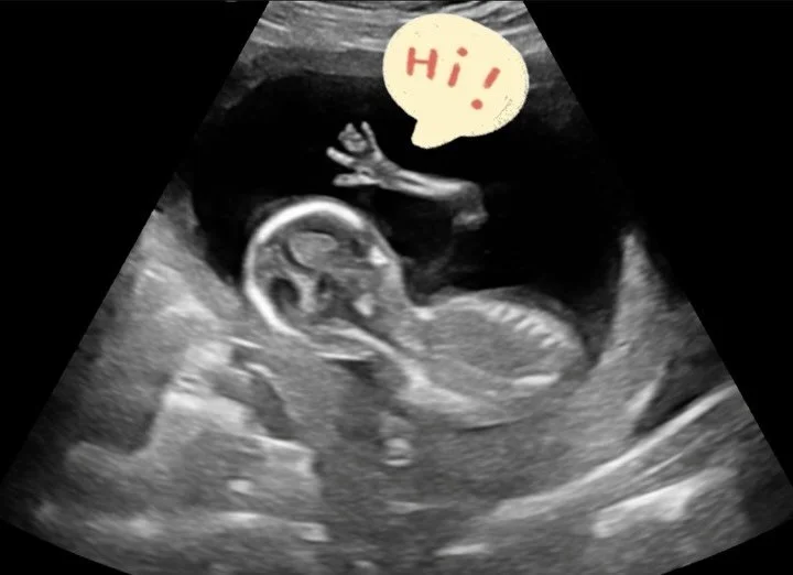 Sweet baby was waving &amp; giving us a show!🥹👋🏼 

This sweet family is getting ready to find out baby&rsquo;s gender very soon&hellip; shhh 🤫 we&rsquo;re keeping the secret just a little longer!

Moments like this are everything!
We can&rsquo;t 