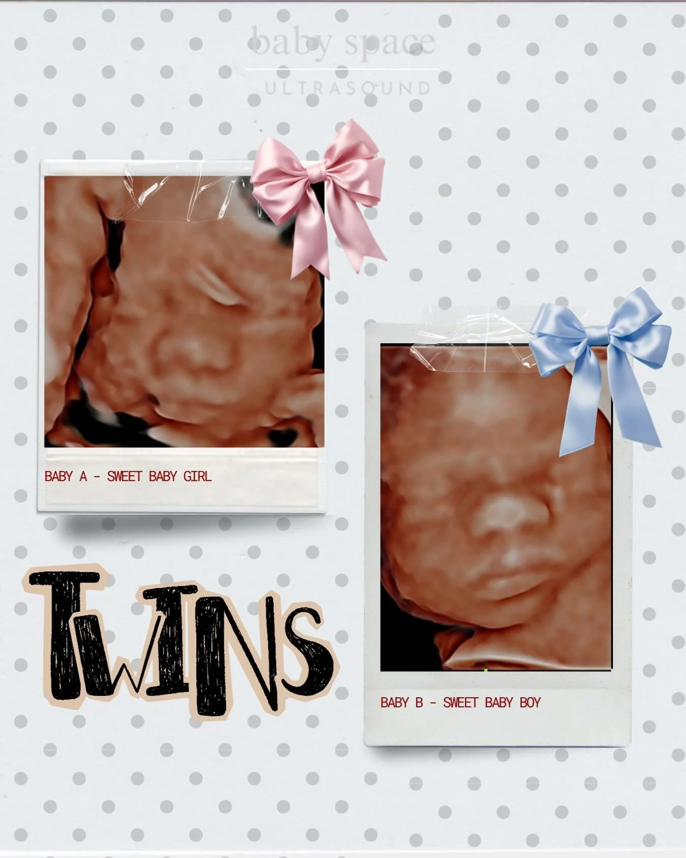 Watching these two sweet twins grow has truly been such an honor. 🥹✨ From the very beginning to now, seeing their little personalities already starting to shine has been the sweetest experience. 

They are already the most precious little babies, ea