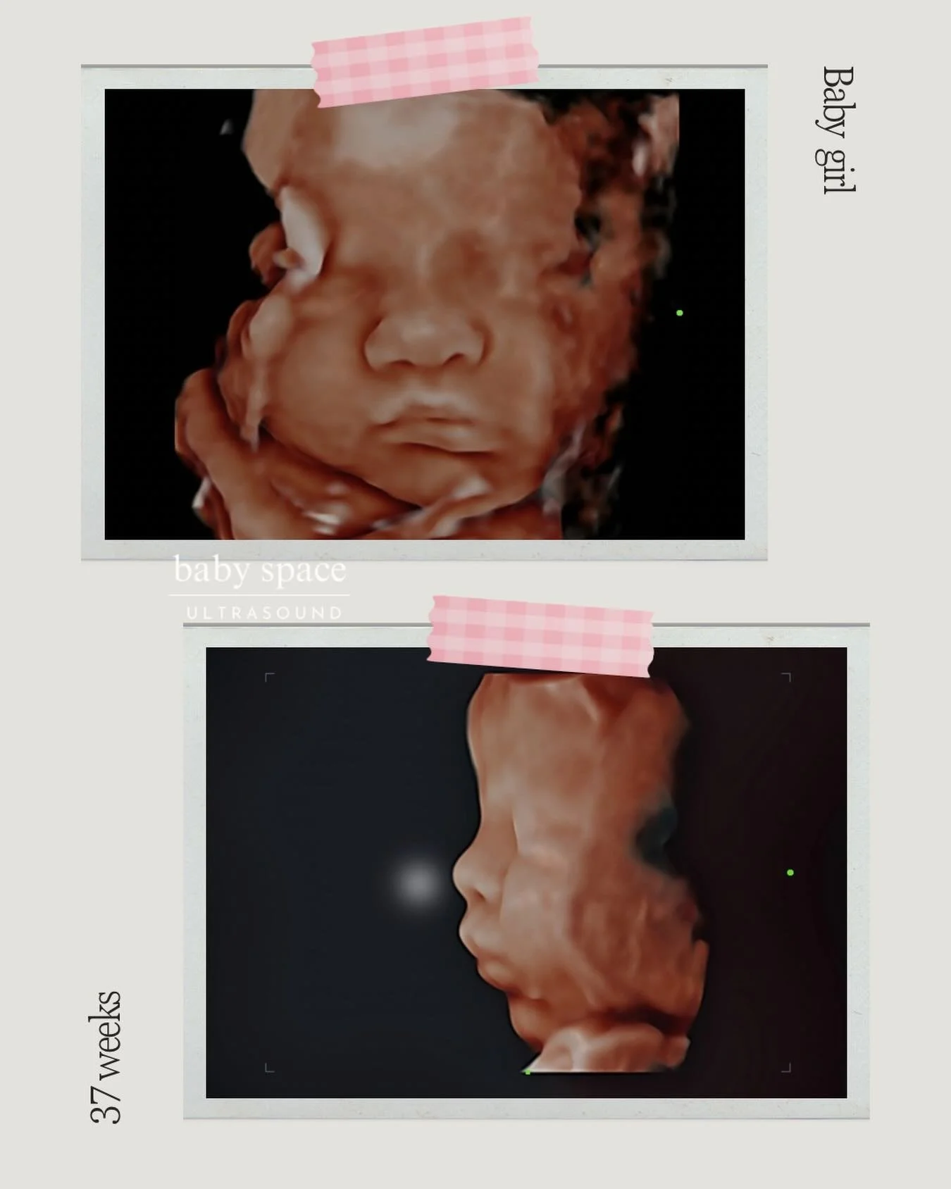 From 6 weeks to now&hellip; what an honor it has been watching this sweet baby girl grow. 🤍 
Getting to be part of this journey and witness each milestone has been so special. 

Such a beautiful family and counting down the days until they welcome t