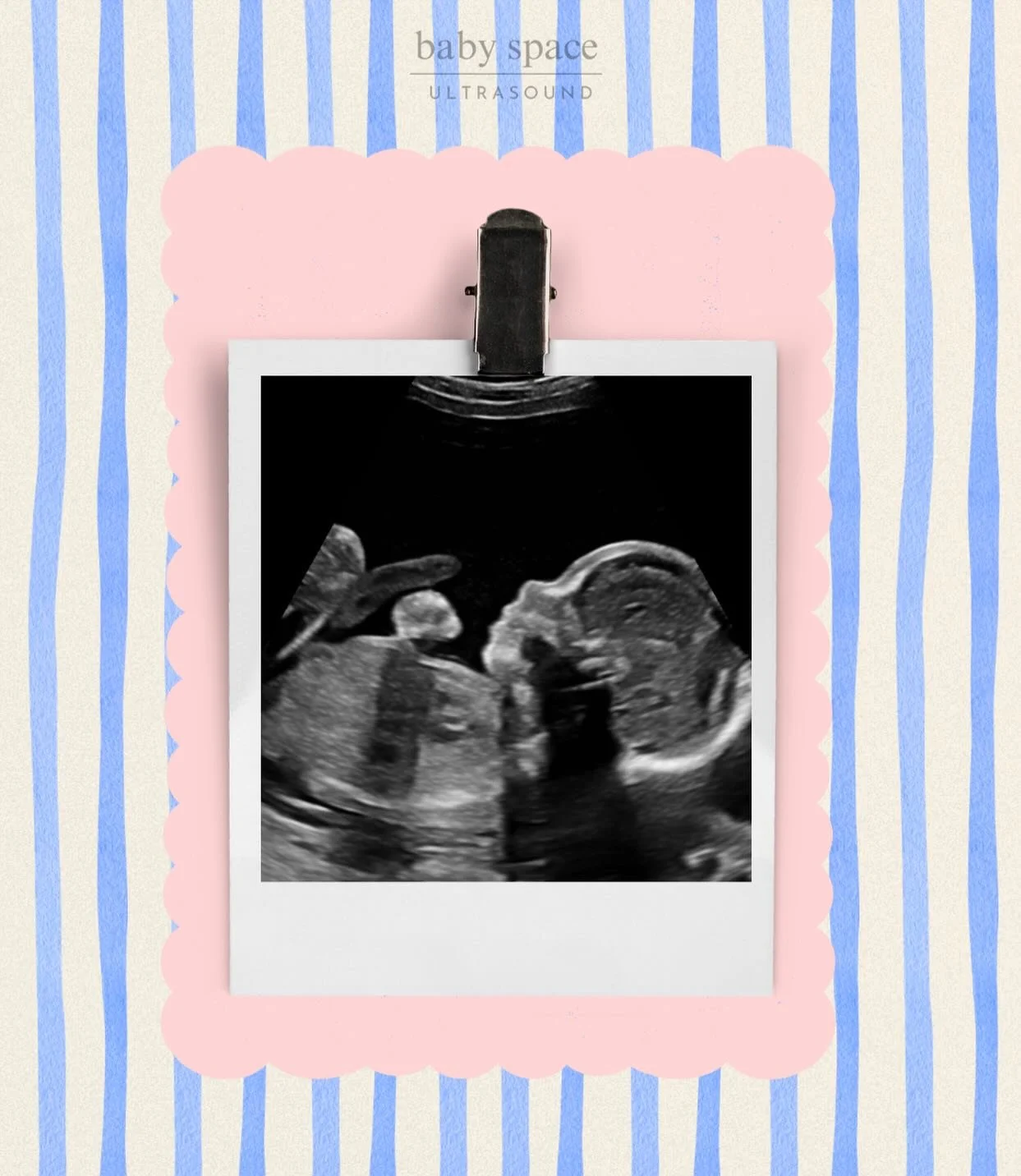 &ldquo;A sweet little side profile moment 🤍✨

Tiny nose, little lips, and already so loved. 🥹

There&rsquo;s something so surreal about seeing your baby&rsquo;s features before they&rsquo;re even here. These are the moments families remember foreve