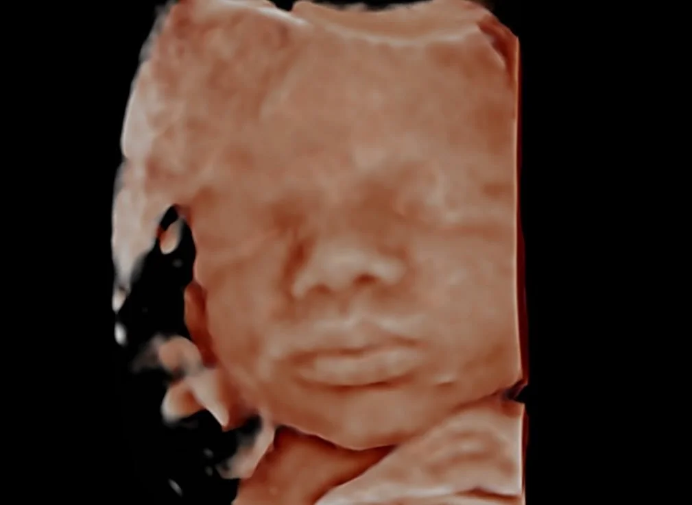 Those lips though!!! 😍💖 
Sweet baby girl was showing off those PERFECT little lips today&hellip; and oh my goodness, she already has a FULL head of hair too!! 

Watching these tiny features come to life during a 3D/4D ultrasound never gets old. She