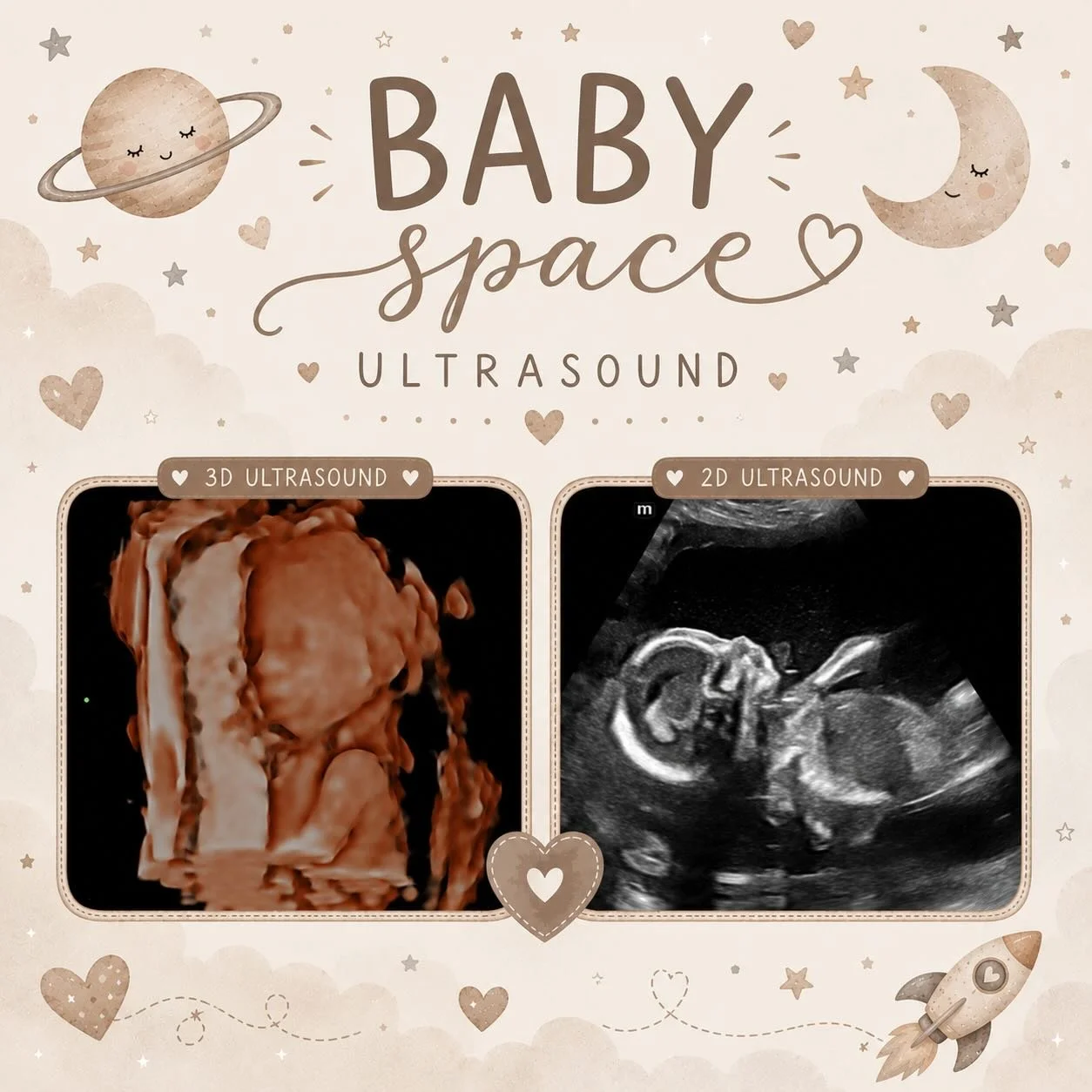 Sweet little features already shining through ✨🤍

From tiny profile views to precious 3D moments, it&rsquo;s such an honor getting to watch these beautiful babies grow before they make their big arrival earthside. 🥹

There is nothing sweeter than s