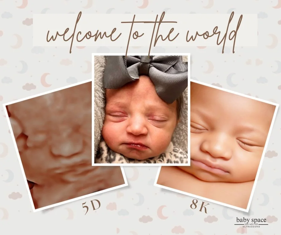 Huge congratulations to this sweet family as they welcome their newest little addition into the world! 🤍 

Isn&rsquo;t she absolutely precious?! And that adorable little bow just makes her even sweeter! 🎀 We are so incredibly happy for this family 