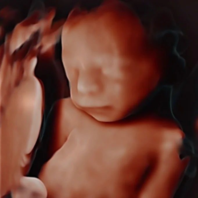 ✨ Wow, wow, wow! ✨

Just look at this incredible 5D/HD image! 😍

This sweet little guy was all snuggled up and clearly knew it was time for his ultrasound photoshoot! 📸🤍 So photogenic already and showing off those adorable features for us. 🥹

#5d
