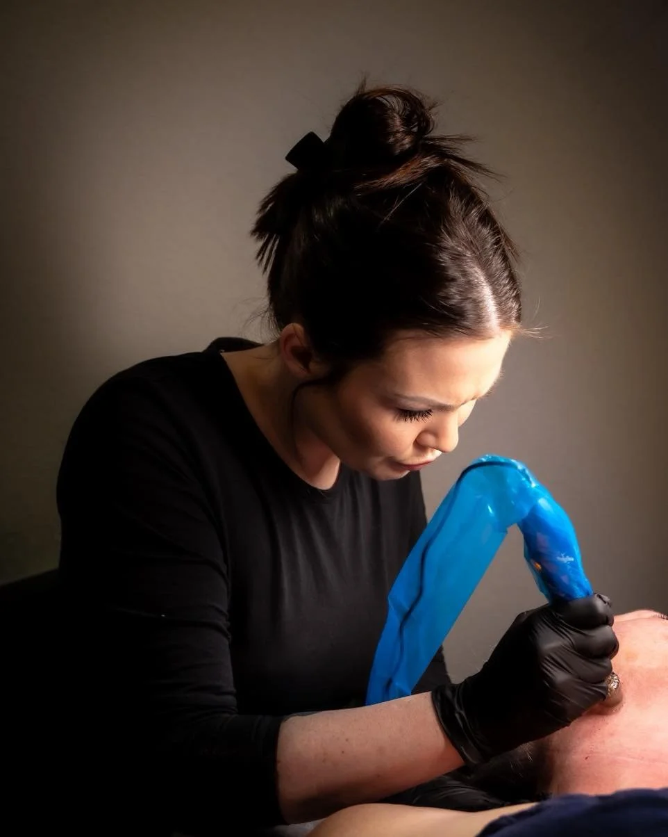 Esthetician performing microneedling on client
