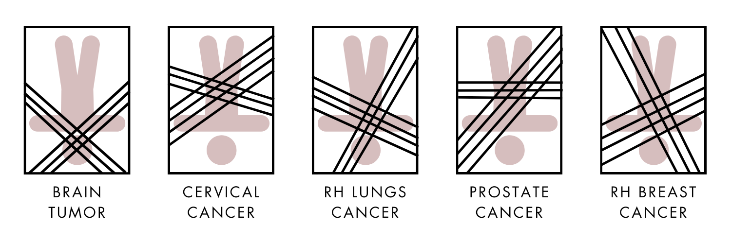 Five ultrasound images showing different types of cancer: brain tumor, cervical cancer, right lung cancer, prostate cancer, and right breast cancer.