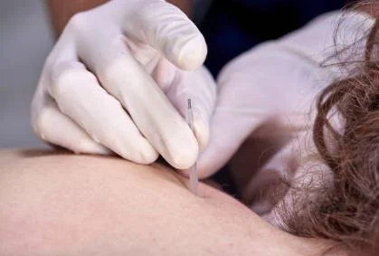 needle 1.JPG