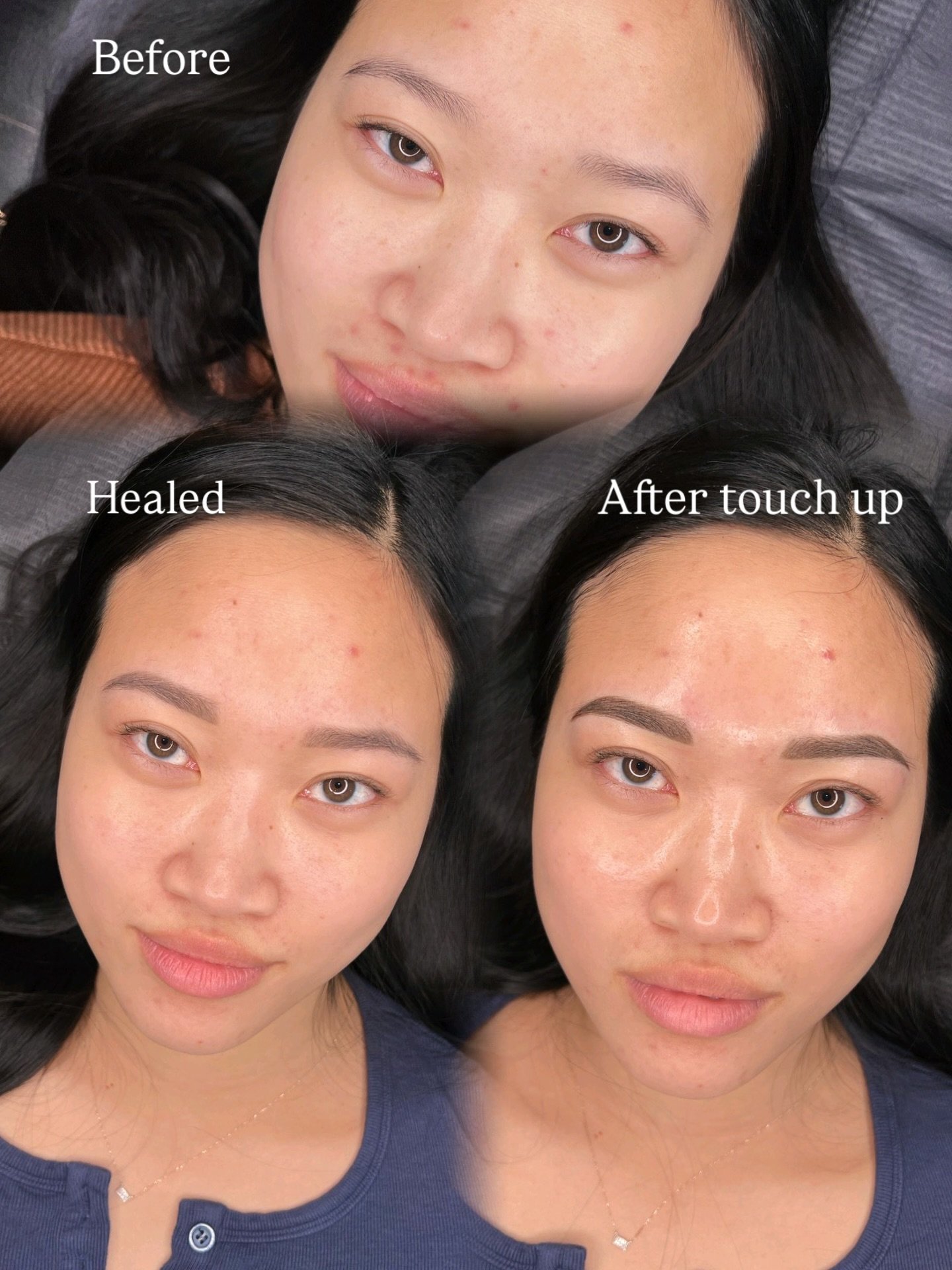 Before➡️Healed➡️After 5-8 week touch up

Before every busy artist is a camera roll that&rsquo;s full of photos and before+afters. She never got around to posting because she overwhelmed. It&rsquo;s not you, it&rsquo;s us I promise 😂💕

#columbus #co