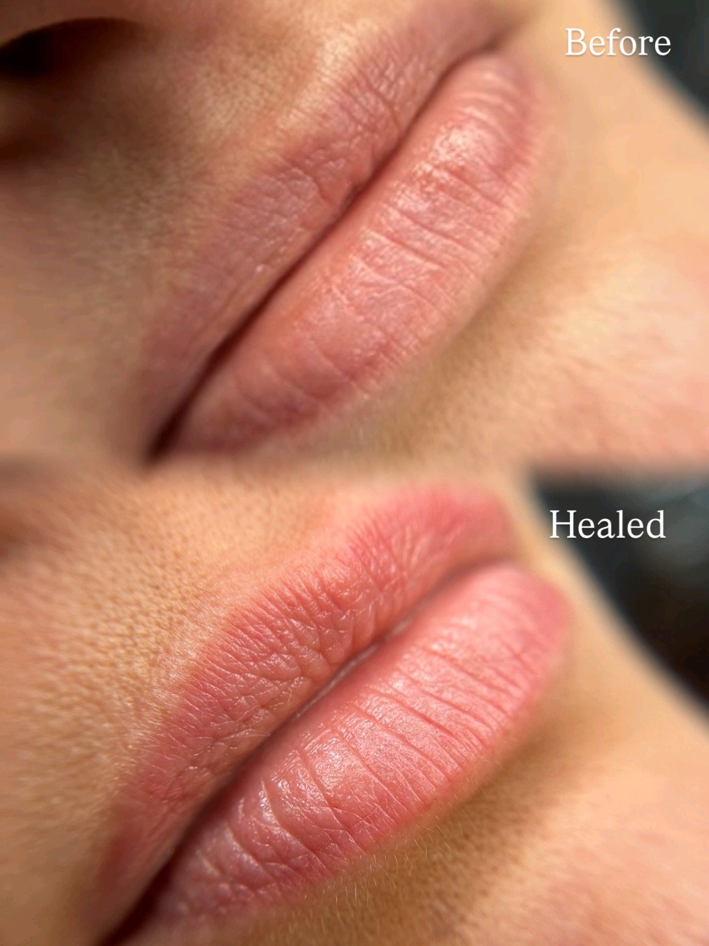 Healed lip blush after 6 weeks. A perfect base to build on❤️&zwj;🔥

If you&rsquo;re lookin for natural looking, kiss and smudge proof lips the I&rsquo;m your girl💋