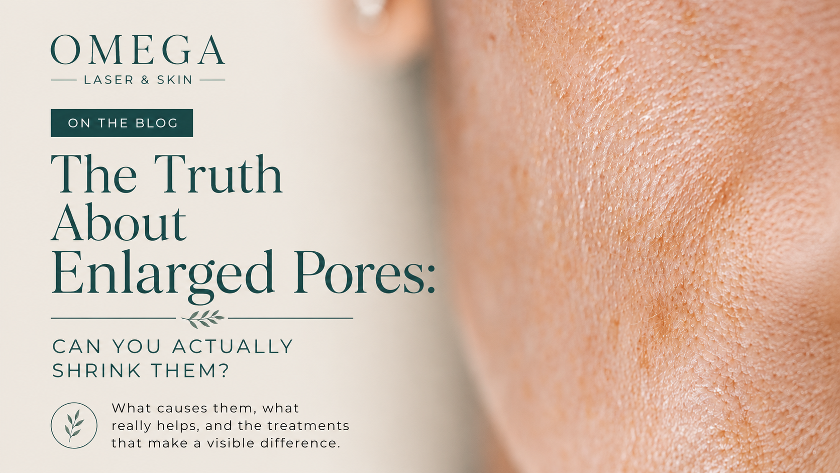 The Truth About Enlarged Pores: Can You Actually Shrink Them?