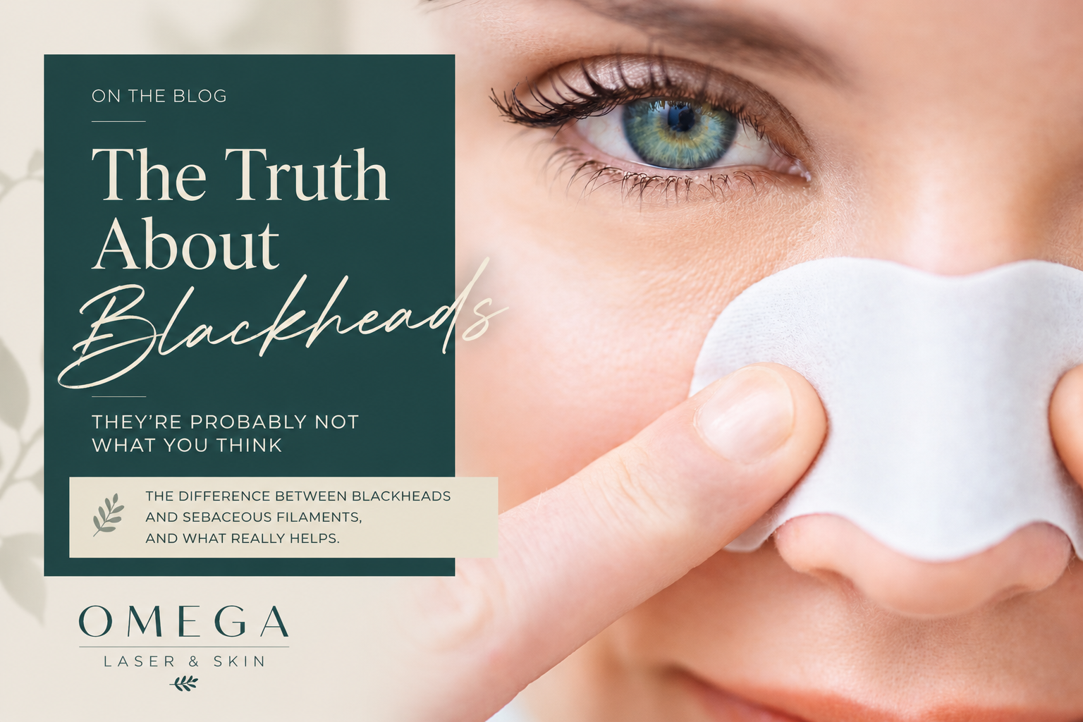 The Truth About Blackheads: They're Probably Not What You Think