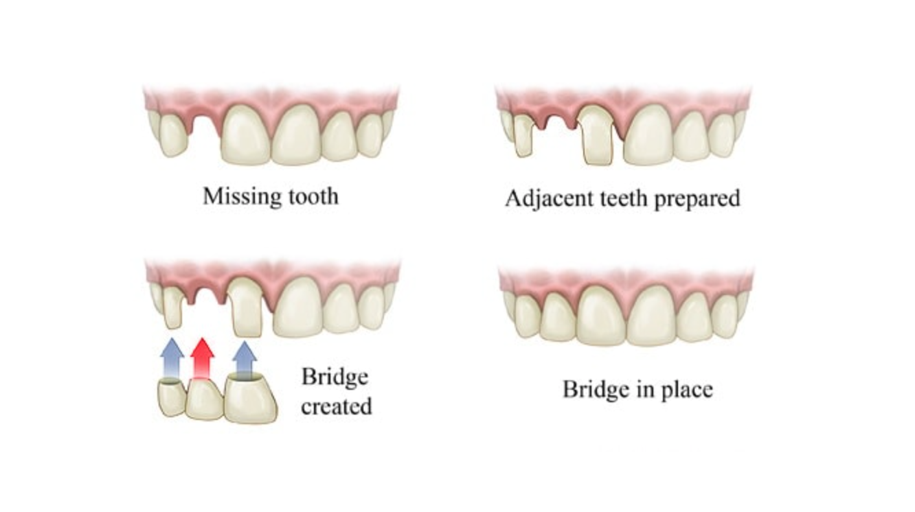 About 5 — High Point Dental