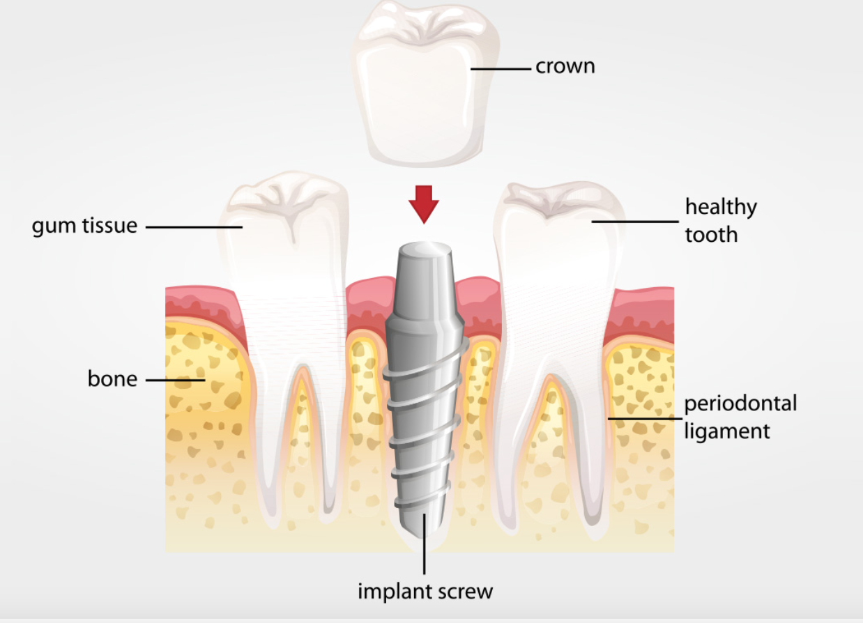 About 5 — High Point Dental
